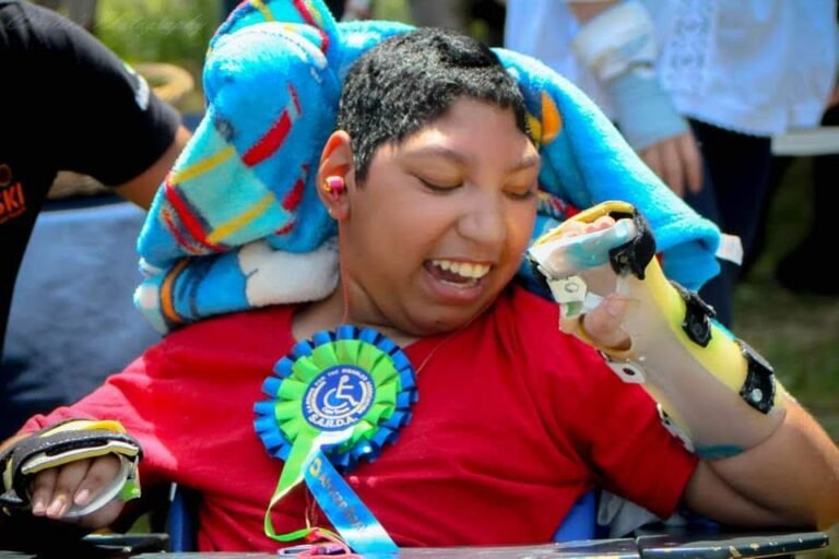 A smiling Special needs child with hand supports braces